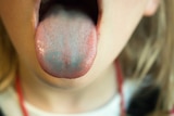 A closeup of a little girl's mouth with her tongue sticking out.