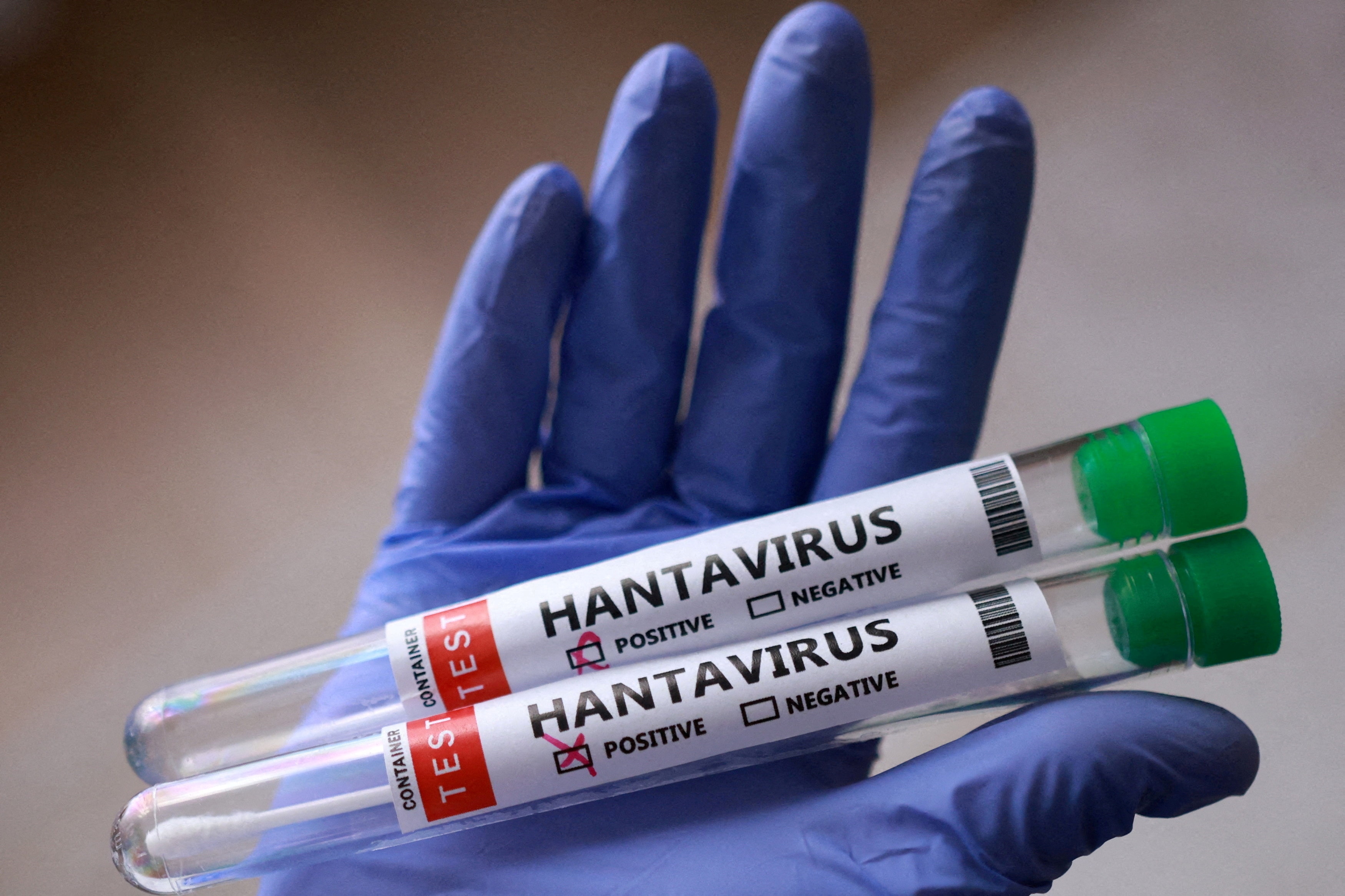 Your questions about the hantavirus outbreak answered