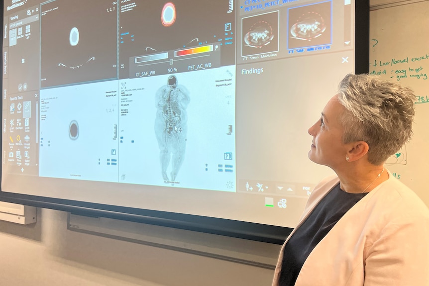 A woman looks at a screen showing a body scan.