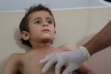 A young boy lying in a hospital bed looks as someone wearing surgical gloves touches his abdomen.