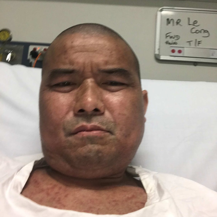 Cong Le lying in a hospital bed for his silicosis treatment