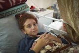 A close up of a young girl with a scar on her face lying in a hospital bed.