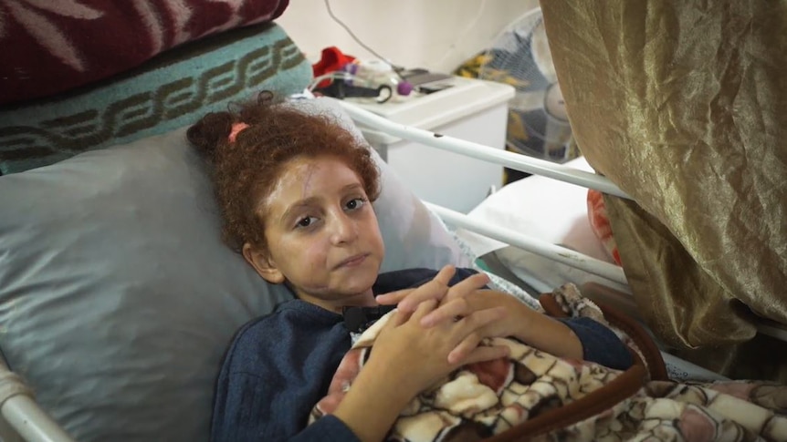 A close up of a young girl with a scar on her face lying in a hospital bed.