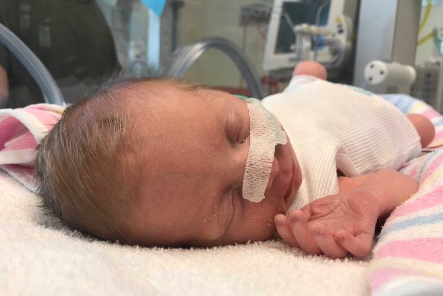 A baby girl, with a nasal tube, lies in a humidicrib in a special care nursery.