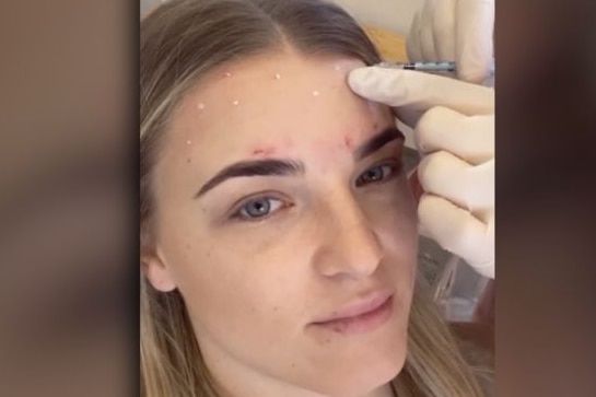 Laura Meadows films her first Botox treatment