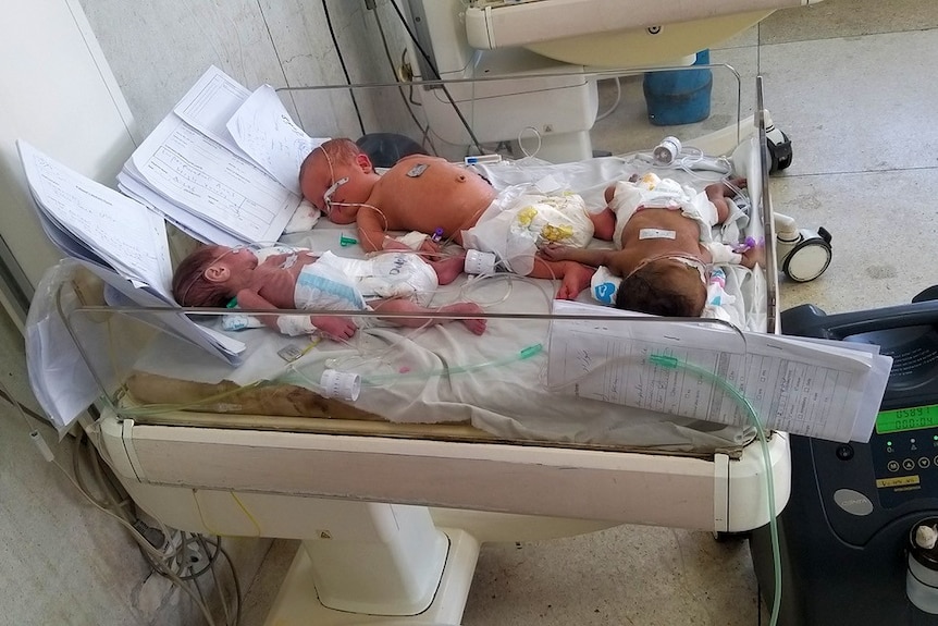Three babies with tubes and cords attached to them share the same hospital crib.