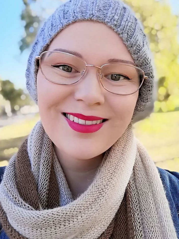A young woman with alopecia wearing a beanie and bright lipstick