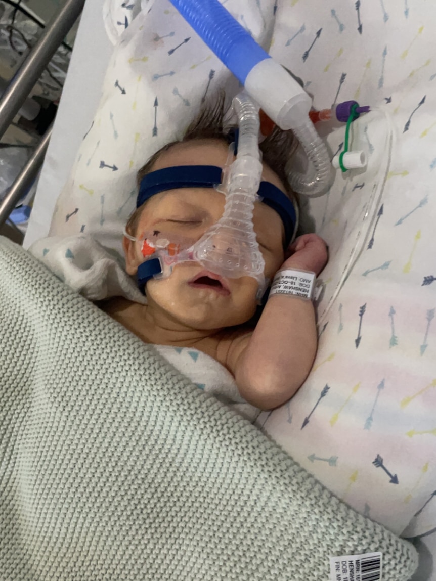A baby with a breathing tube in 