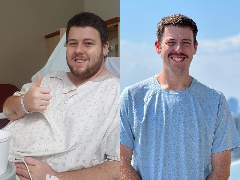 Nick Ham before and after weight-loss surgery.