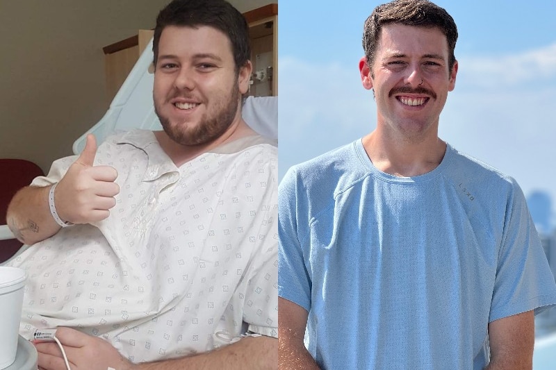 Nick Ham before and after weight-loss surgery.