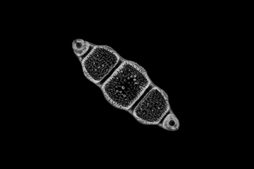 Biddulphia rigida diatom from Oamaru, NZ.