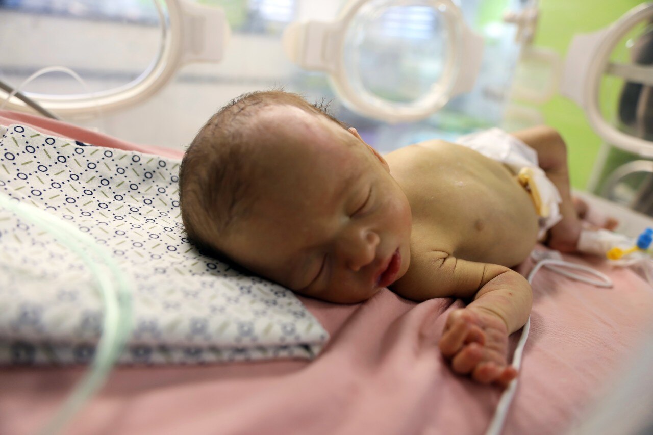 A malnourished young child in an incubator