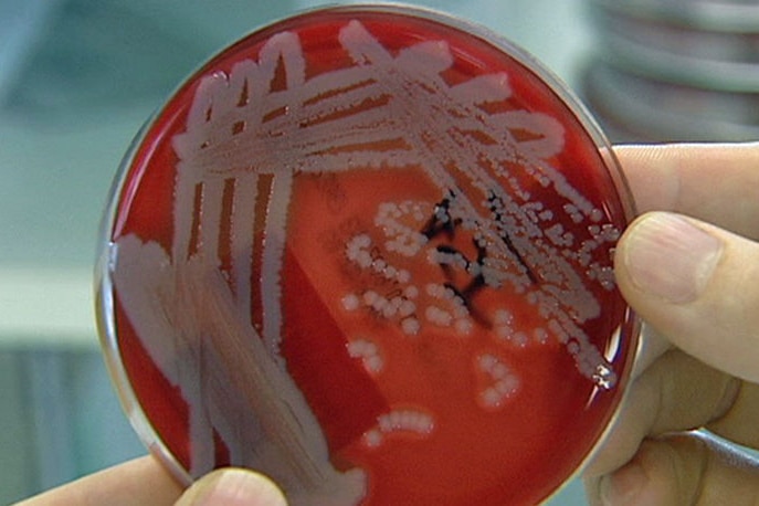a close up of a hand holding a red petri dish