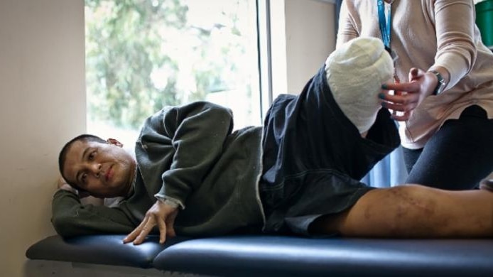 Ismail Marzuki ketika menjalani terapi tidak lama setelah kakinya diamputasi di tahun 2014