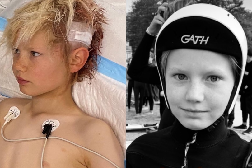 two photos side by side, one of a boy in hospital with his head patched up and the same boy in a wetsuit and helmet at the beach
