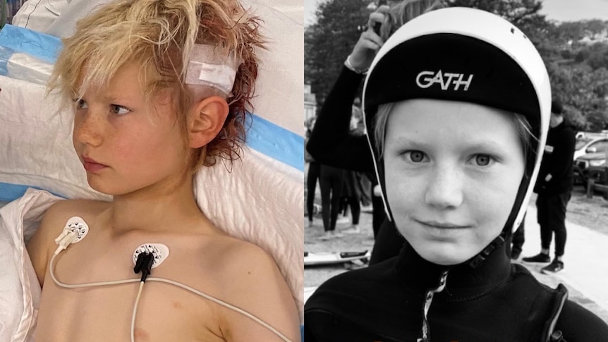 two photos side by side, one of a boy in hospital with his head patched up and the same boy in a wetsuit and helmet at the beach