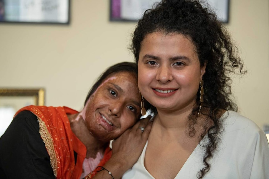 A woman with scars on her face hugs another woman