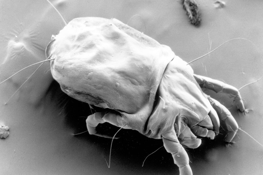 Microscope image of a dust mite