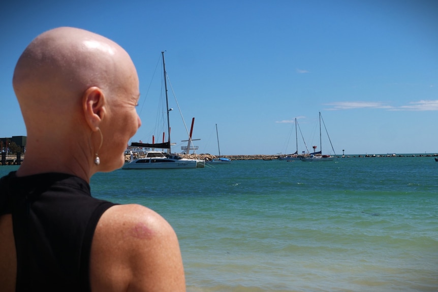 A woman without hair stands on a beach at looks out to sea.