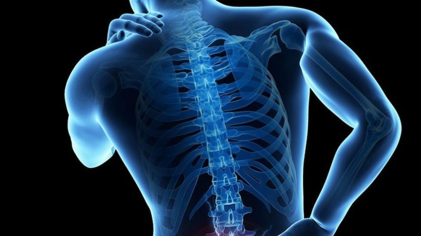 More than 3.7 million Australians suffer from low back pain at any one time.