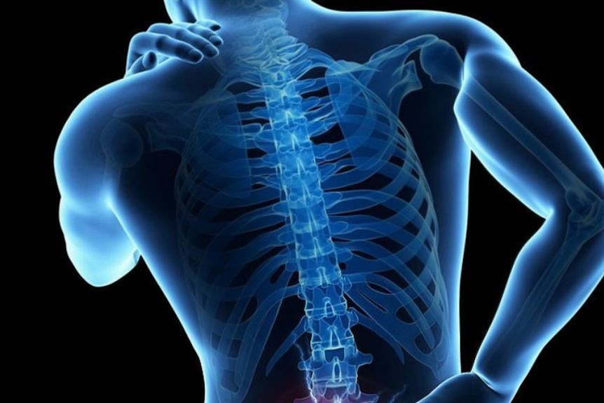 More than 3.7 million Australians suffer from low back pain at any one time.