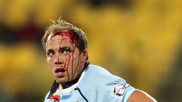 Gutsy performance: Phil Waugh leaves the field with a nasty cut.