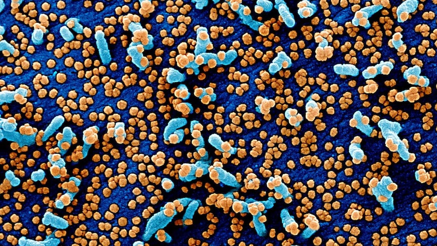 A colourised scanning electron micrograph image of a VERO E6 cell (blue) heavily infected with SARS-COV-2 virus