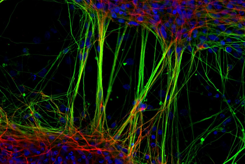 an extremely magnified image of human neurons lit up in fluoro green blue and red