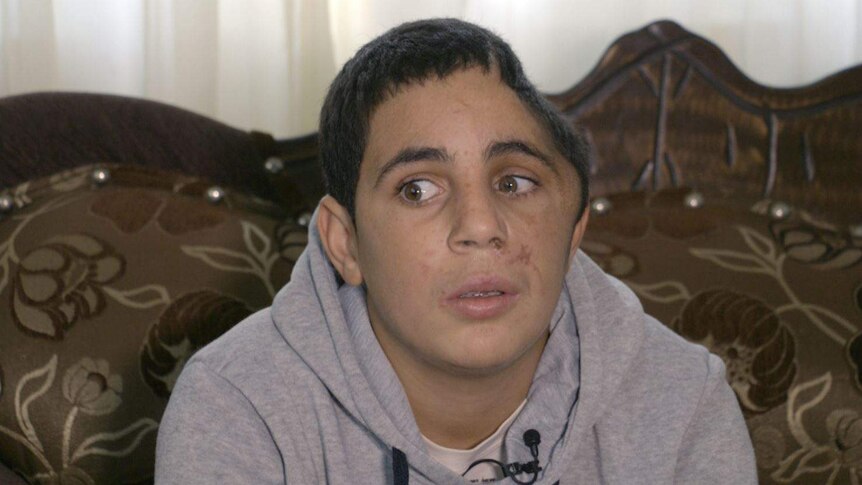 Ahed Tamimi's 15-year-old cousin Mohammad, who is missing part of his skull.