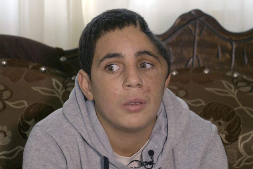 Ahed Tamimi's 15-year-old cousin Mohammad, who is missing part of his skull.