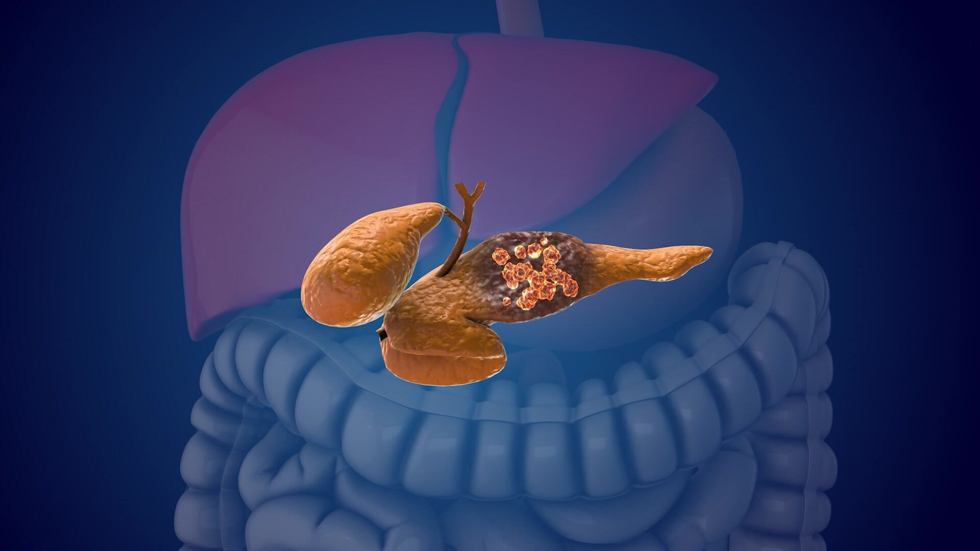 The pilot program is based on the fact that some cases of diabetes are ...