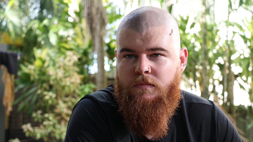 Man with long orange beard and a shaved head looks unhappy with stitches on his forehead 