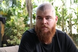 Man with long orange beard and a shaved head looks unhappy with stitches on his forehead 