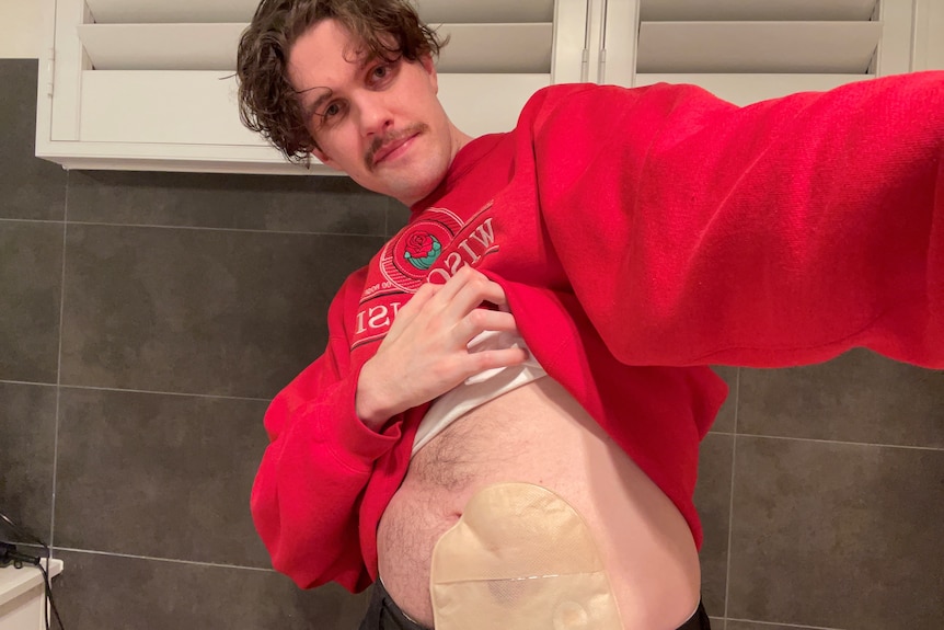 Harrison takes a bathroom selfie, his red jumper lifted up to show his stoma bag.