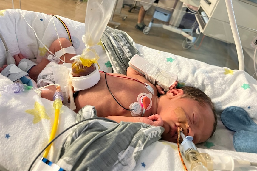 Newborn baby Harrison McLaren attached to medical equipment in hospital