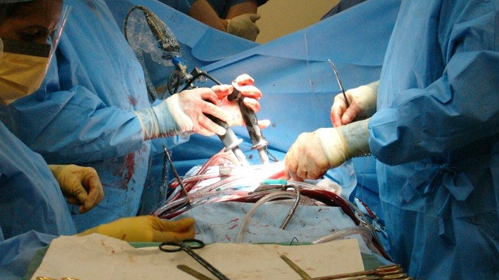 Doctors performing heart surgery