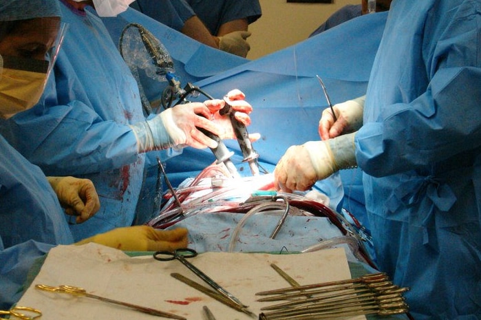 Doctors performing heart surgery