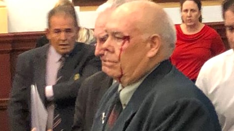 A man in a suit holds papers while blood trickles from a cut above his left eye.