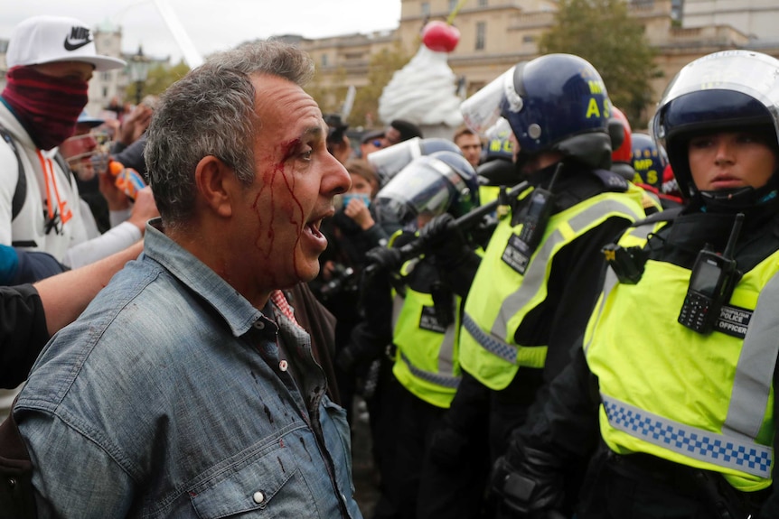 A man with blood running down from his eyebrow faces UK riot police in a crowd