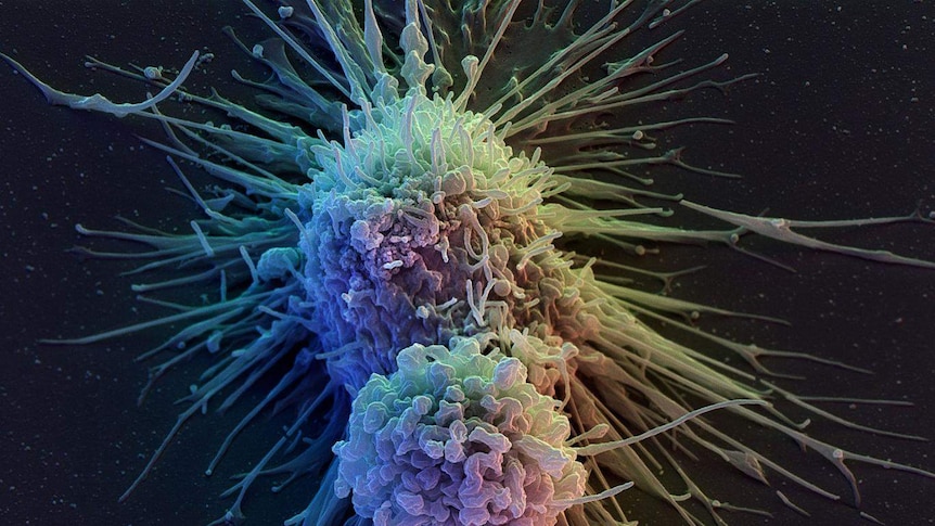 Lymphoblast cells