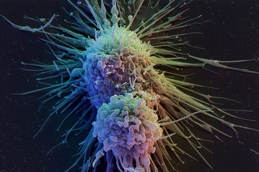 Lymphoblast cells