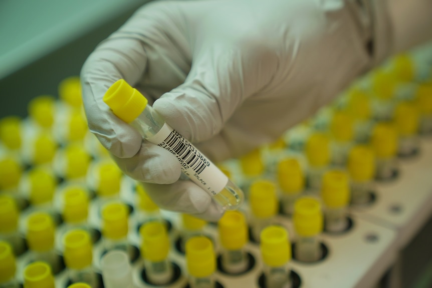 A gloved hand holds up a small test vial.