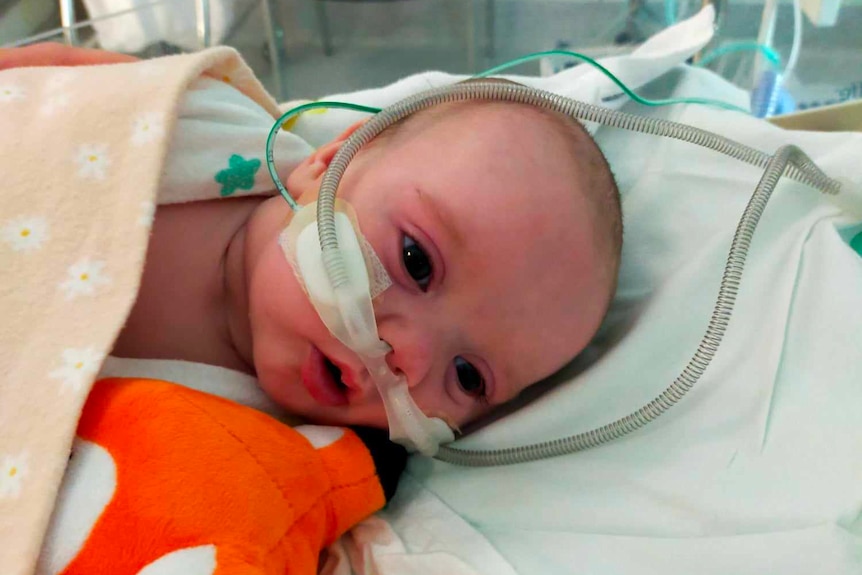 Baby in hospital bed with tubes in nose