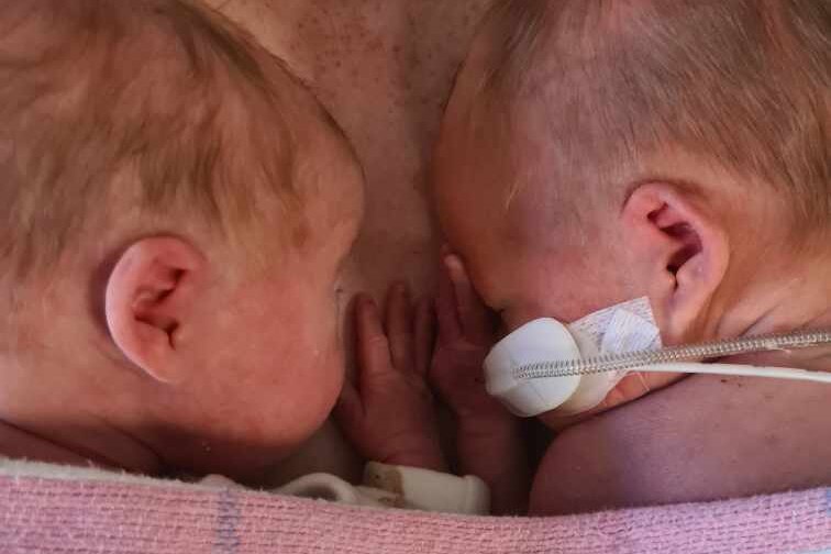 premature newborns lying on their mother's chest