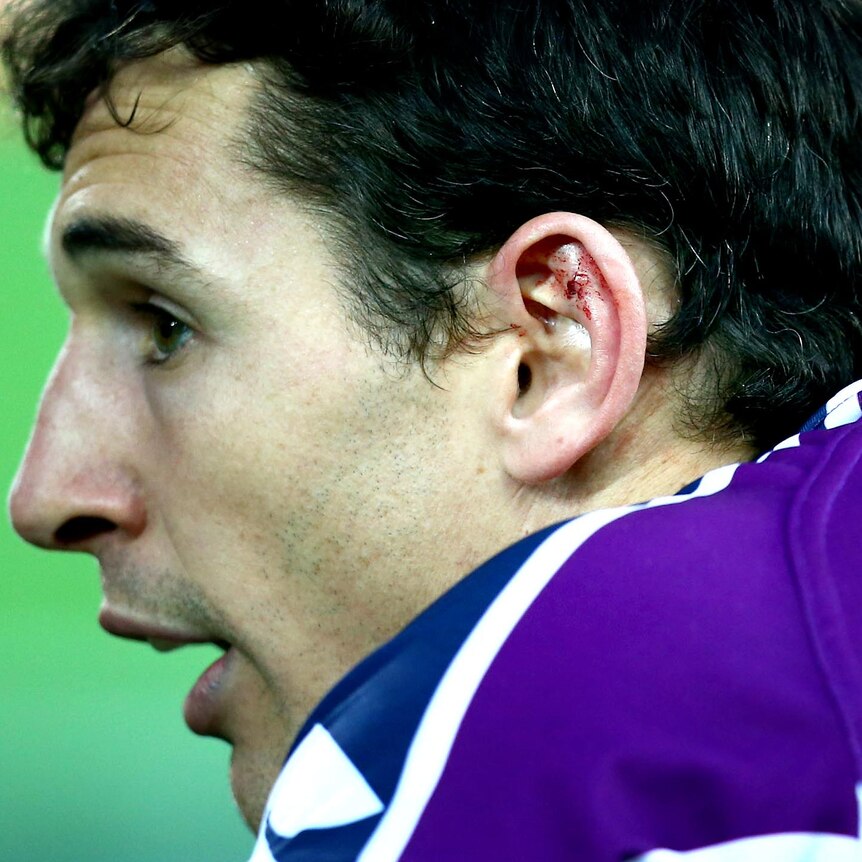 Blood appears visible in Billy Slater's left ear after a scuffle early on in the NRL grand final.