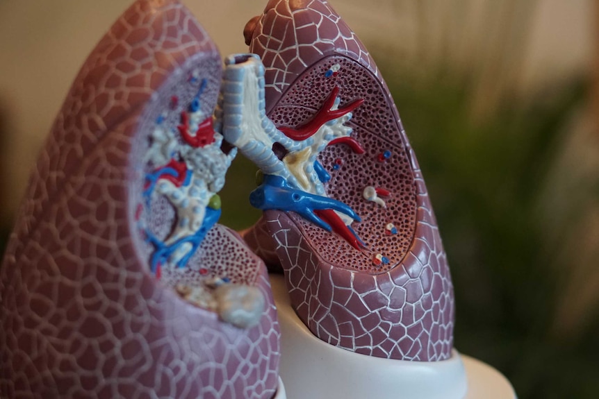 A model showing the interior structure of the lungs