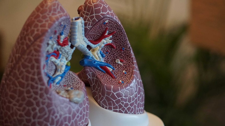 The Lung Foundation says the federal government must implement cancer screening to save 12,000 lives