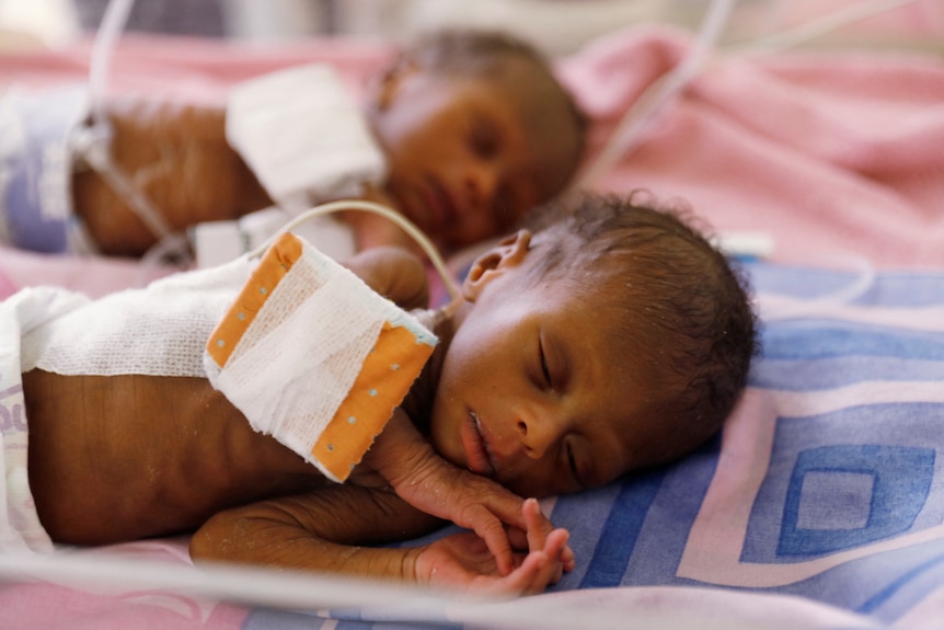 Two skinny new born babies with drips attached to them. 