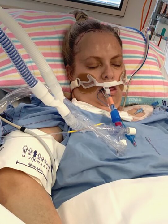 An unconscious woman in an intensive care bed, connected to a ventilator.