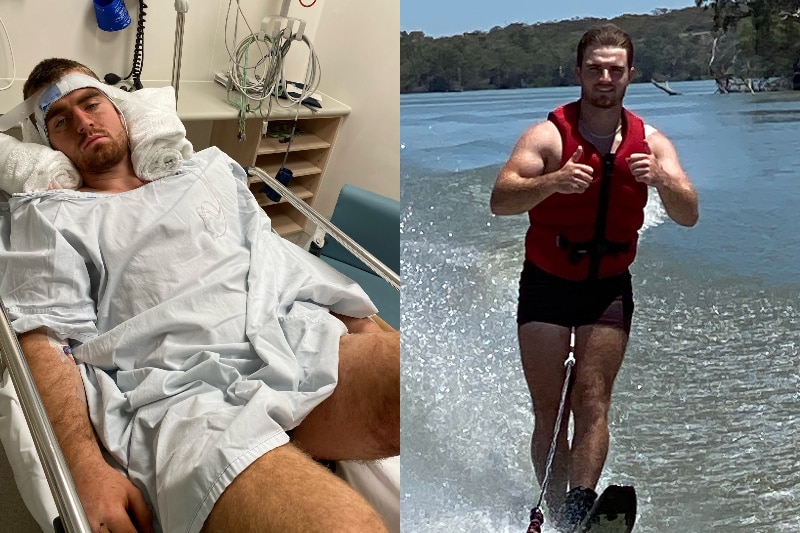 Left image shows a young man bruised in a hospital bed. Right image shows the same young man fit and happy water skiing.